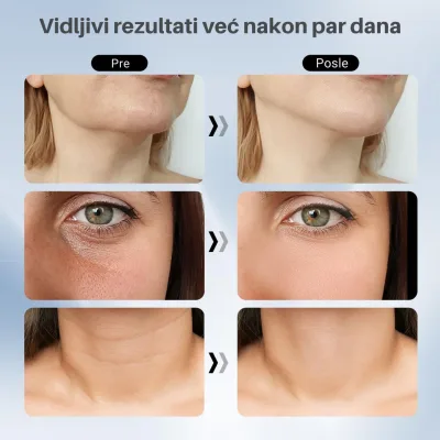 DermaLux – Zategnuta i blistava koža bez bora - Slika 4