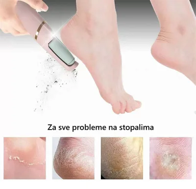 Električna turpija za pete i stopala – Vaš kućni salon lepote