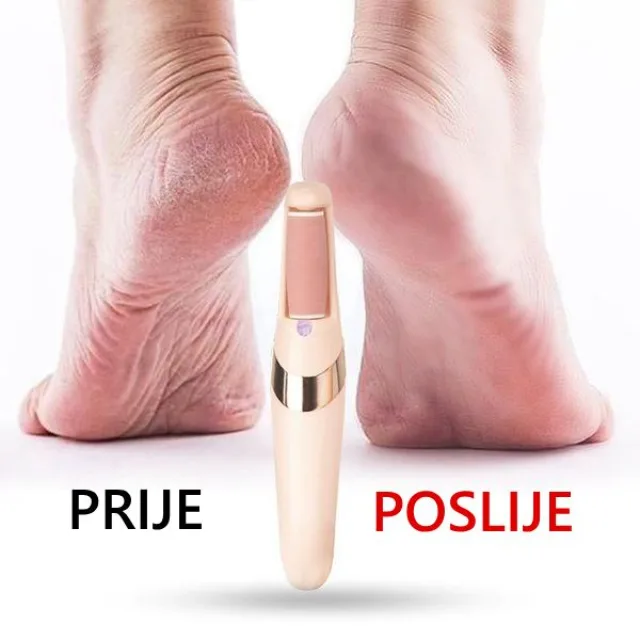 Električna pedikir turpija za pete i stopala