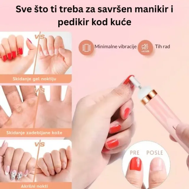 Sve što vam treba u jednom setu
